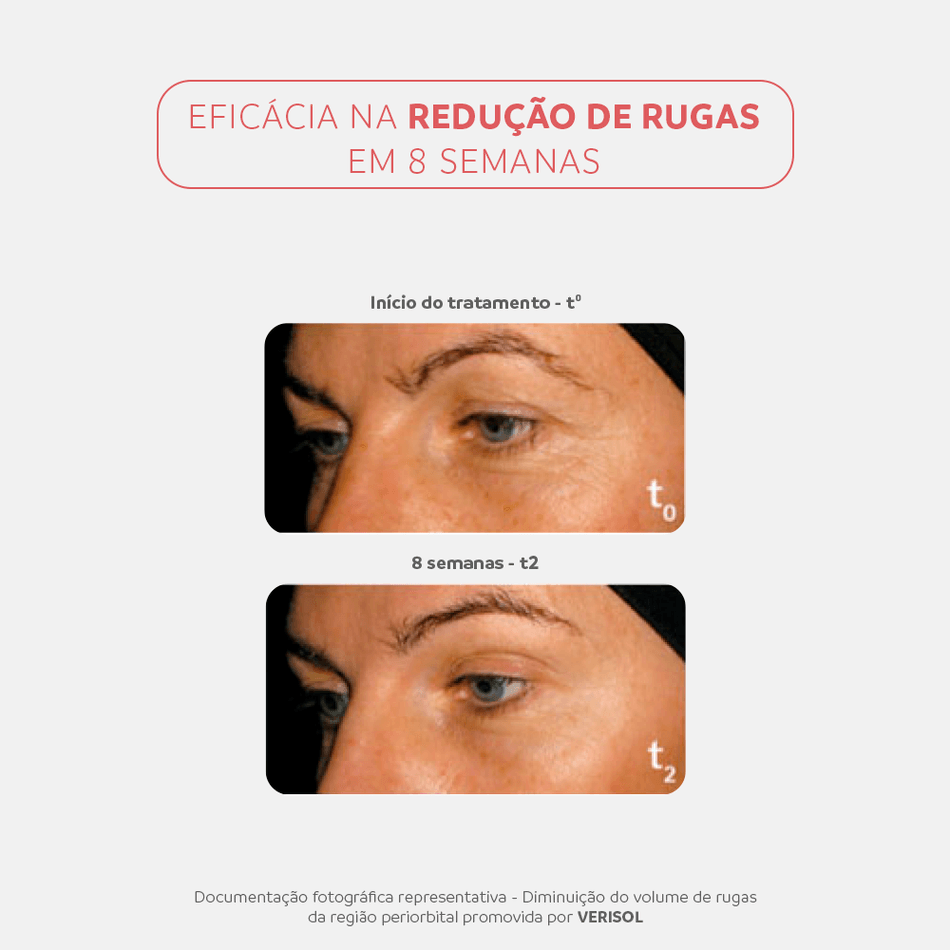 Kit Ineout Collagen Gummies Dermage Booster de Colágeno e Elastina
